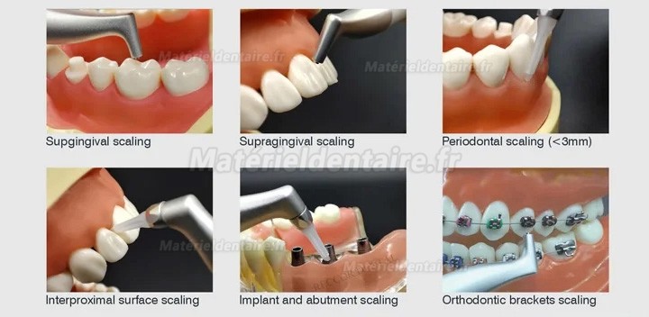 Aéropolisseur dentaire VolDent AirJet 1 (seule pièce à main supragingivale)